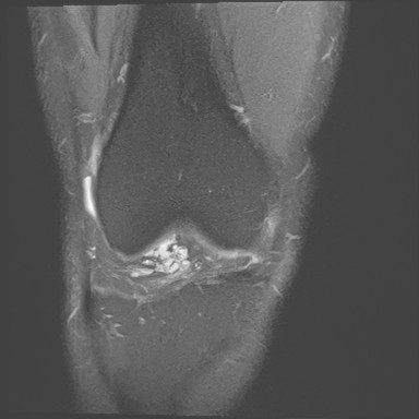 Figure 4 for case Orthovisc injections